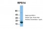 RPS14 antibody - middle region